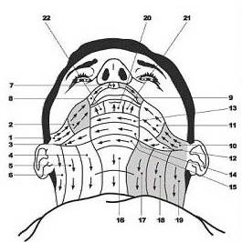 Observation implantation pileuse